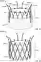 Fig. 06 - Prosthetic aortic heart valves