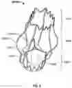 Fig. 07 - Prosthetic aortic heart valves