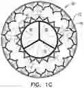 Fig. 03 - Prosthetic heart valve implant