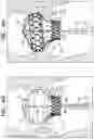 Fig. 09 - Prosthetic heart valve implant