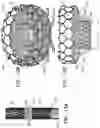 Fig. 18 - Prosthetic heart valve implant
