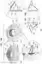 Fig. 20 - Prosthetic heart valve implant