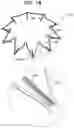 Fig. 24 - Prosthetic heart valve implant