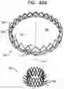 Fig. 26 - Prosthetic heart valve implant
