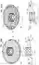 Fig. 27 - Prosthetic heart valve implant