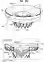Fig. 29 - Prosthetic heart valve implant