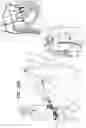 Fig. 32 - Prosthetic heart valve implant