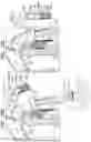 Fig. 33 - Prosthetic heart valve implant
