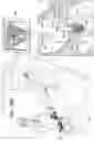 Fig. 37 - Prosthetic heart valve implant