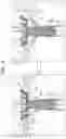 Fig. 12 - Prosthetic valve with separably-deployable valve body and tissue anchors
