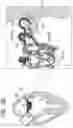 Fig. 16 - Prosthetic valve with separably-deployable valve body and tissue anchors
