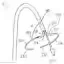Fig. 01 - Treatment catheter member with encircling function