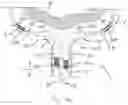 Fig. 02 - Treatment catheter member with encircling function