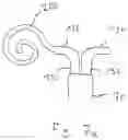 Fig. 14 - Treatment catheter member with encircling function
