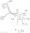 Fig. 15 - Treatment catheter member with encircling function