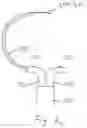 Fig. 16 - Treatment catheter member with encircling function
