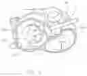Fig. 17 - Treatment catheter member with encircling function