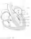 Fig. 22 - Treatment catheter member with encircling function