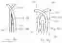 Fig. 26 - Treatment catheter member with encircling function
