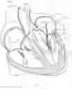 Fig. 27 - Treatment catheter member with encircling function