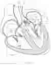Fig. 28 - Treatment catheter member with encircling function