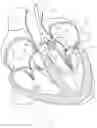 Fig. 29 - Treatment catheter member with encircling function