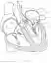 Fig. 30 - Treatment catheter member with encircling function