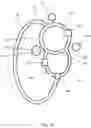 Fig. 09 - Hybrid heart valve function tester specifically designed for production evaluation of prosthetic heart valve products