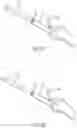 Fig. 10 - PARTIAL JOINT RESURFACING IMPLANT, INSTRUMENTATION, AND METHOD