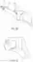 Fig. 11 - PARTIAL JOINT RESURFACING IMPLANT, INSTRUMENTATION, AND METHOD