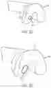 Fig. 24 - PARTIAL JOINT RESURFACING IMPLANT, INSTRUMENTATION, AND METHOD