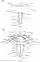 Fig. 45 - PARTIAL JOINT RESURFACING IMPLANT, INSTRUMENTATION, AND METHOD