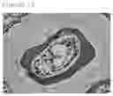 Fig. 12 - Medical use honeycomb structure