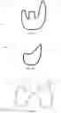 Fig. 09 - Systems and methods for manufacturing, preparation and use of blanks in orthopedic implants