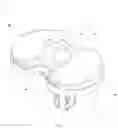 Fig. 02 - Artificial knee joint