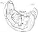 Fig. 01 - Knee prosthesis system and method