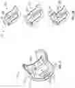 Fig. 04 - Knee prosthesis system and method