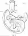 Fig. 05 - Knee prosthesis system and method