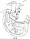 Fig. 07 - Knee prosthesis system and method