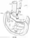 Fig. 09 - Knee prosthesis system and method