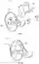 Fig. 12 - Knee prosthesis system and method