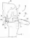 Fig. 01 - Methods and instrumentation for balancing of ligaments in flexion