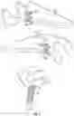 Fig. 04 - Glenoid fossa prosthesis