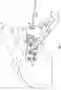 Fig. 07 - Glenoid fossa prosthesis