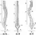 Fig. 02 - Device and method for correcting spinal deformities in patients