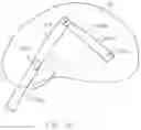 Fig. 30 - Expandable interbody spacer