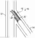 Fig. 01 - FLANGE STENT DEVICE AND MODULAR STENT SYSTEM THEREOF