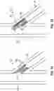 Fig. 02 - FLANGE STENT DEVICE AND MODULAR STENT SYSTEM THEREOF