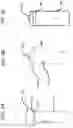 Fig. 07 - FLANGE STENT DEVICE AND MODULAR STENT SYSTEM THEREOF
