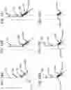 Fig. 16 - FLANGE STENT DEVICE AND MODULAR STENT SYSTEM THEREOF